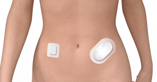 Wearables _ Insulin pump bonded to abdomen.png